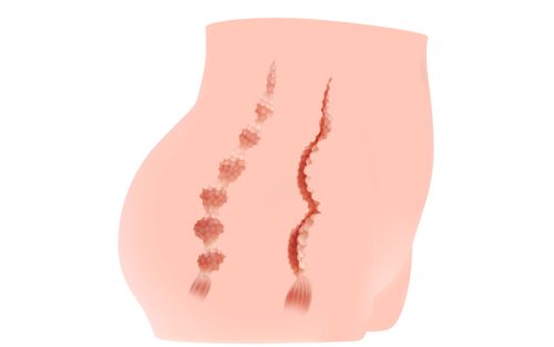 Real Hip Cherry - Image 6